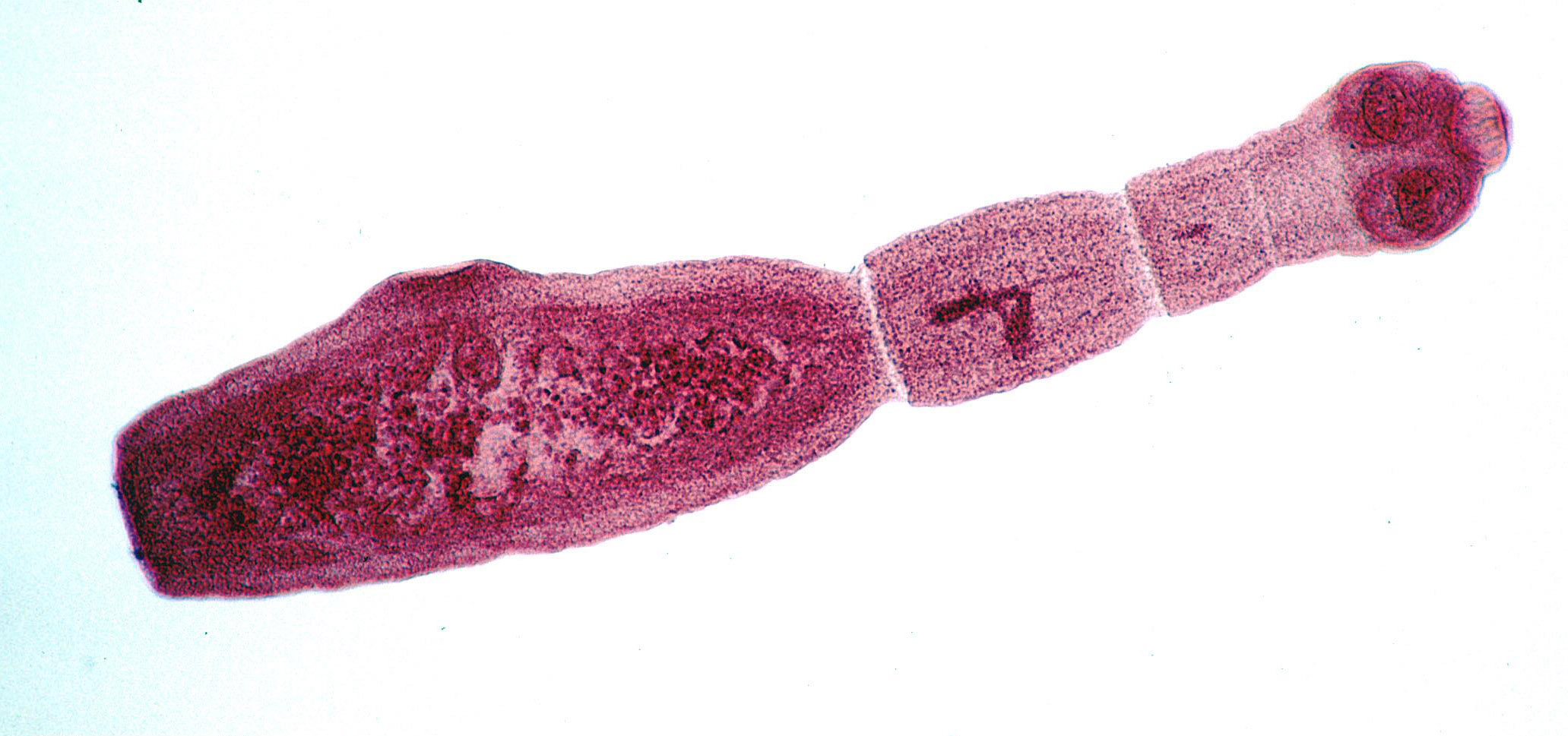 Fuchsbandwurm - Echinococcus multilocularis - Ausgewachsener Bandwurm (Alan R Walker, CC BY-SA 3.0, via Wikimedia Commons)